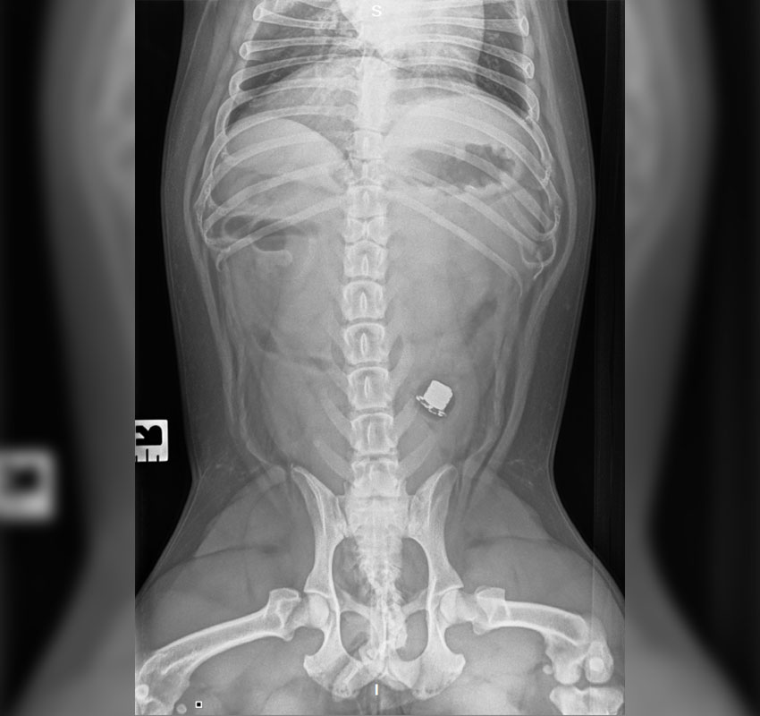 X-ray image of a human torso, showing the spine, ribs, and pelvis, with a small rectangular object visible in the abdominal area, indicating a possible swallowed foreign object.