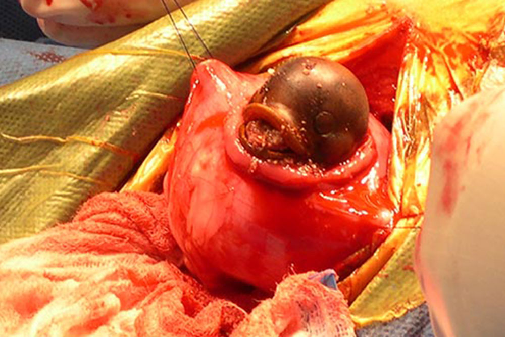 A close-up surgical image showing an exposed and surrounded by tissue organ, possibly an eye, during a complex medical procedure performed by a veterinarian. The area is covered with surgical drapes, instruments, and visible blood, indicating an active operative environment.