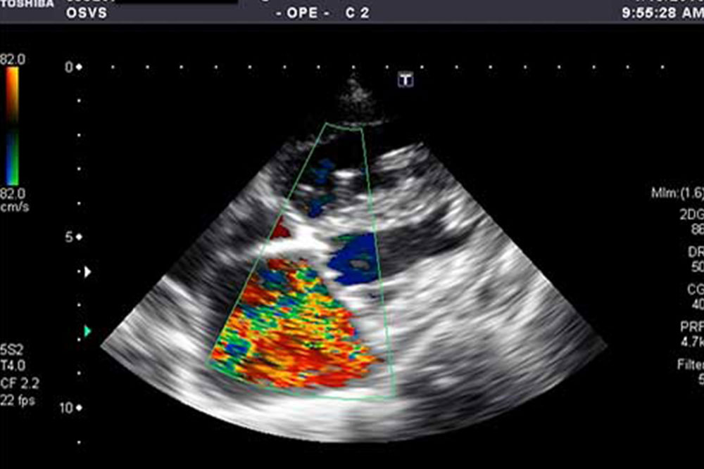 An ultrasound image with color Doppler showing blood flow within a heart's chambers. The veterinarian can observe the color overlay indicating the direction and velocity of blood flow, with areas of red and blue representing different flow directions.