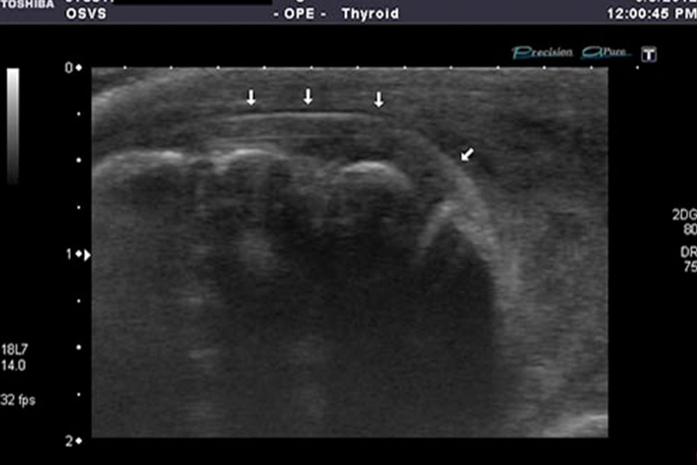 A medical ultrasound image of the thyroid gland shows several small, round hypoechoic nodules indicated by white arrows. The image includes standard ultrasound markings and labels at the top and side, with a small text in the top-right corner indicating "Toshiba." Even veterinarians use similar imaging techniques for diagnosing pets.