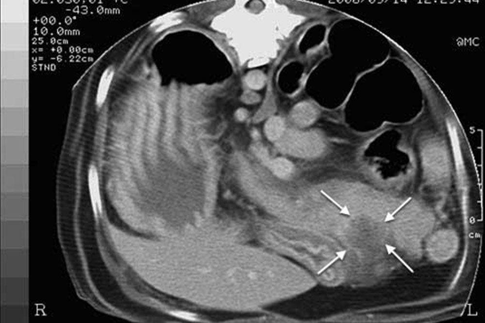A grayscale abdominal CT scan image with four white arrows pointing to a specific area on the lower left side of the abdomen. The scan, often used by a vet, shows various anatomical structures with varying levels of density.